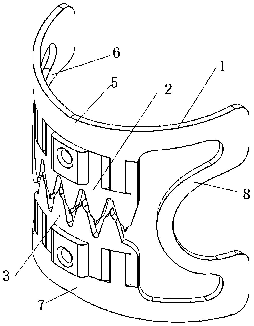 Detachable anastomosis clip