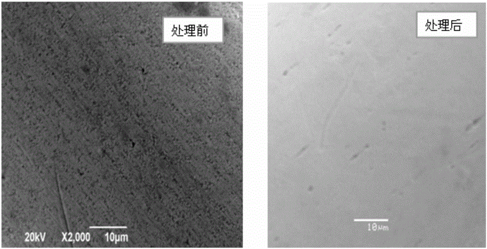 Surface treatment method for material nickel-titanium alloy for left aurcle plugging device