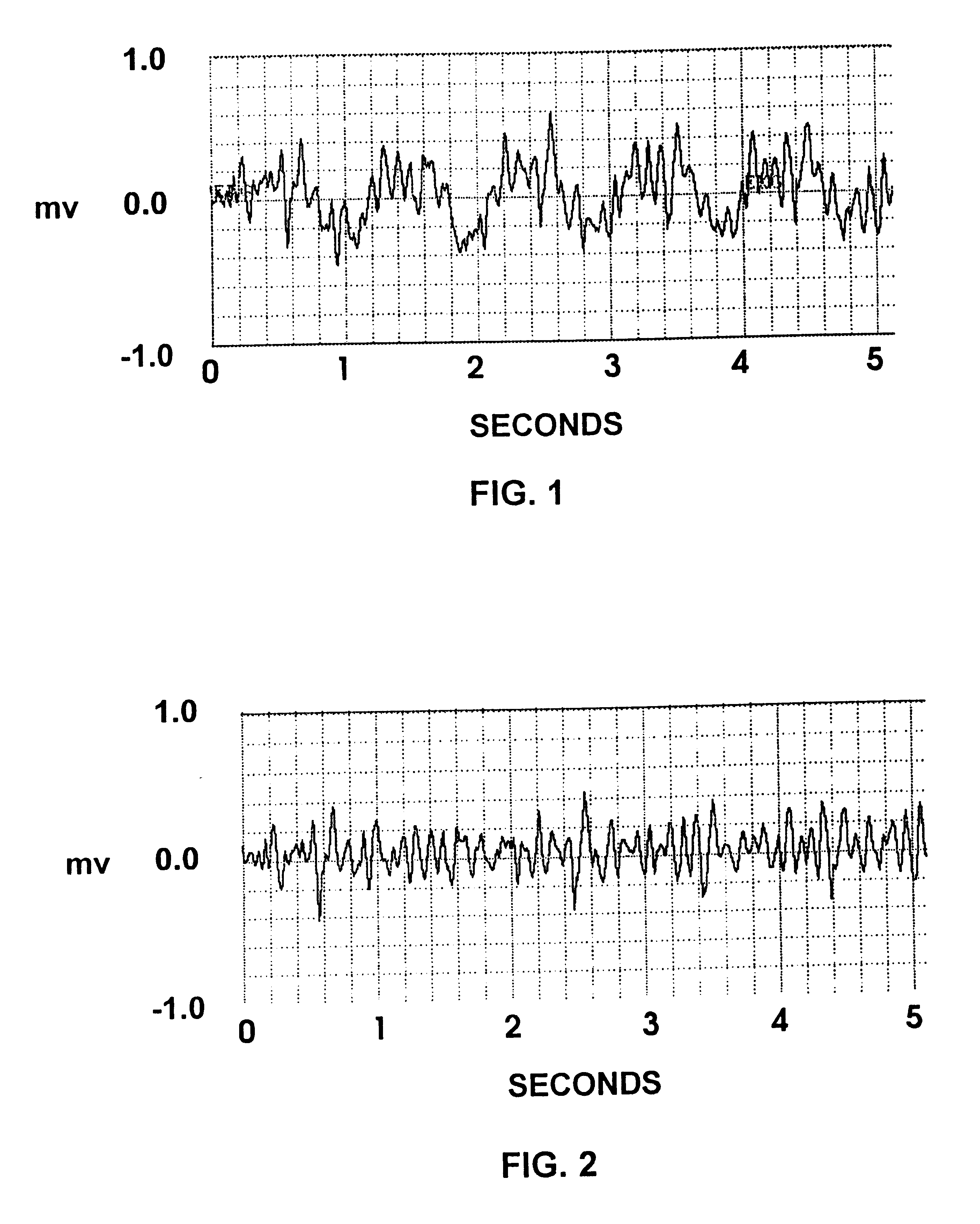 Method and system for predicting the immediate success of a defibrillatory shock during cardiac arrest