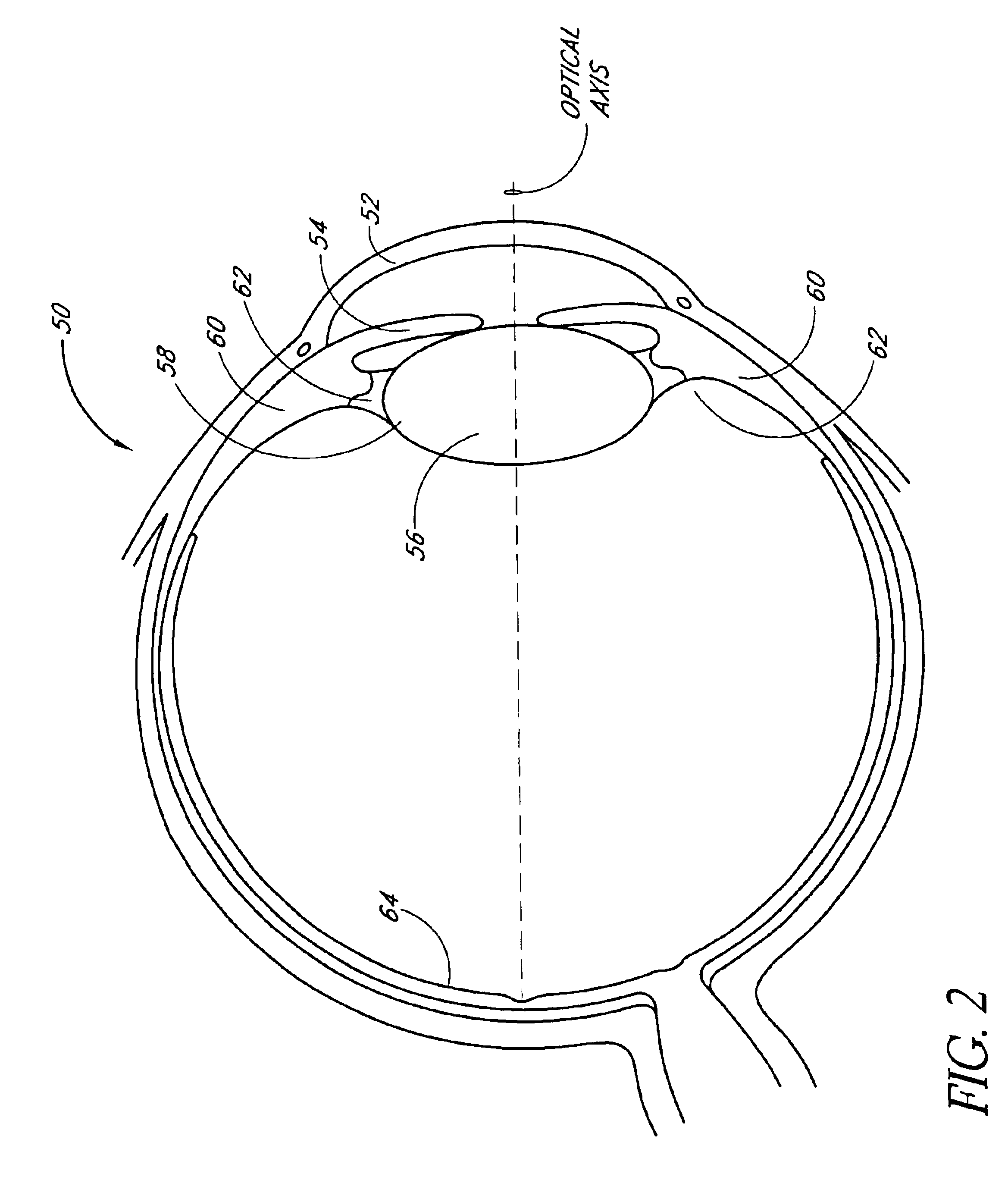 Method of preparing an intraocular lens for implantation