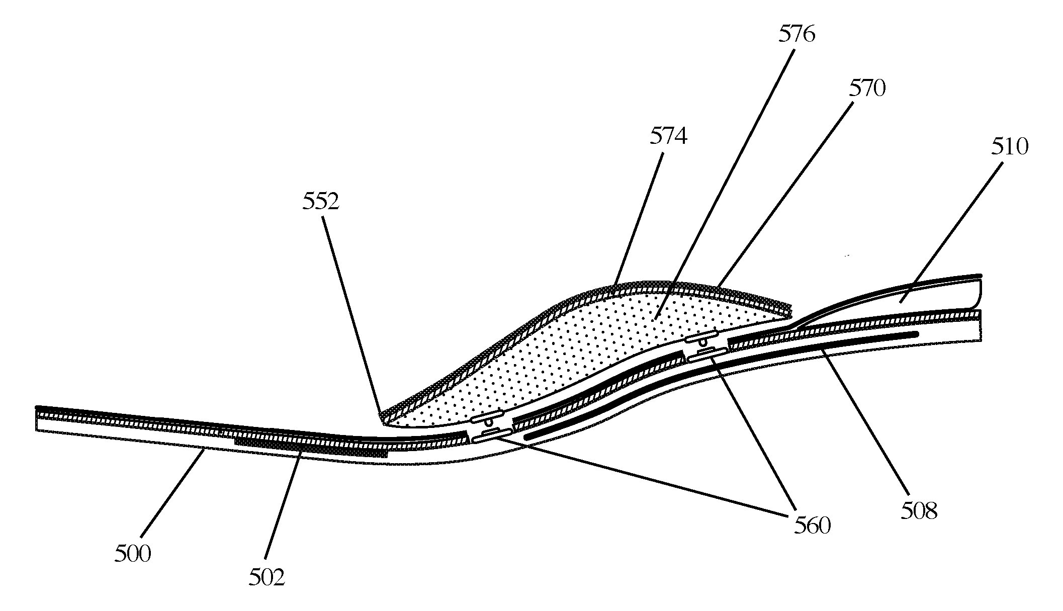 Customizable Arch Support System