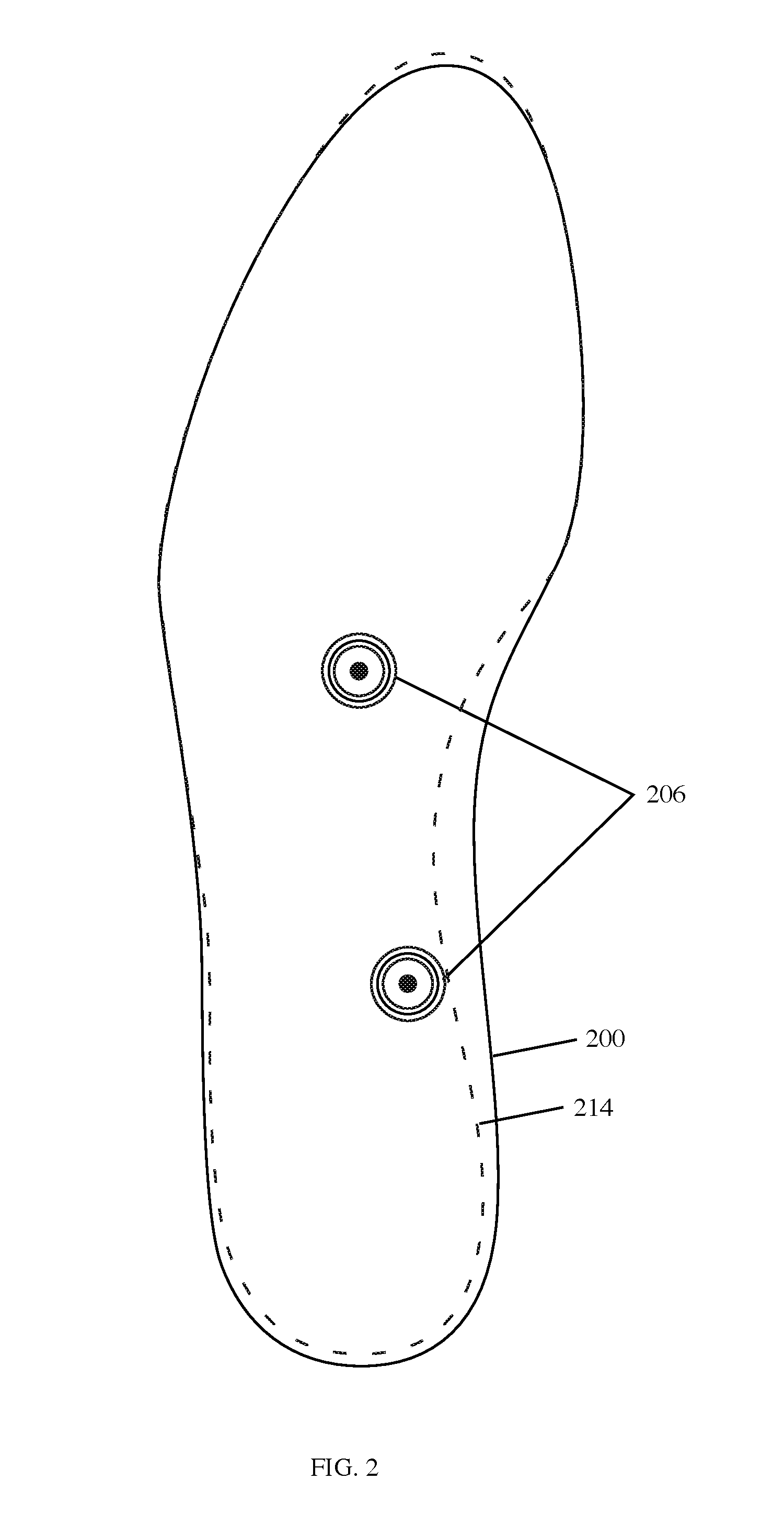 Customizable Arch Support System