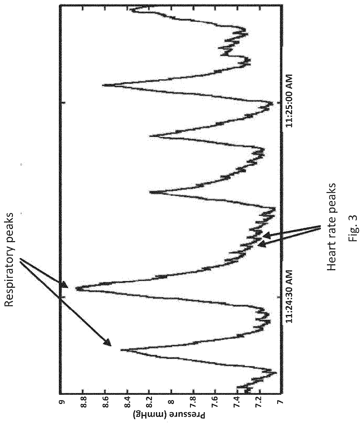 Systems, devices and methods for draining and analyzing bodily fluids and assessing health