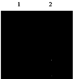 Detection kit used for detecting echinococcus shiquicus (larvae)