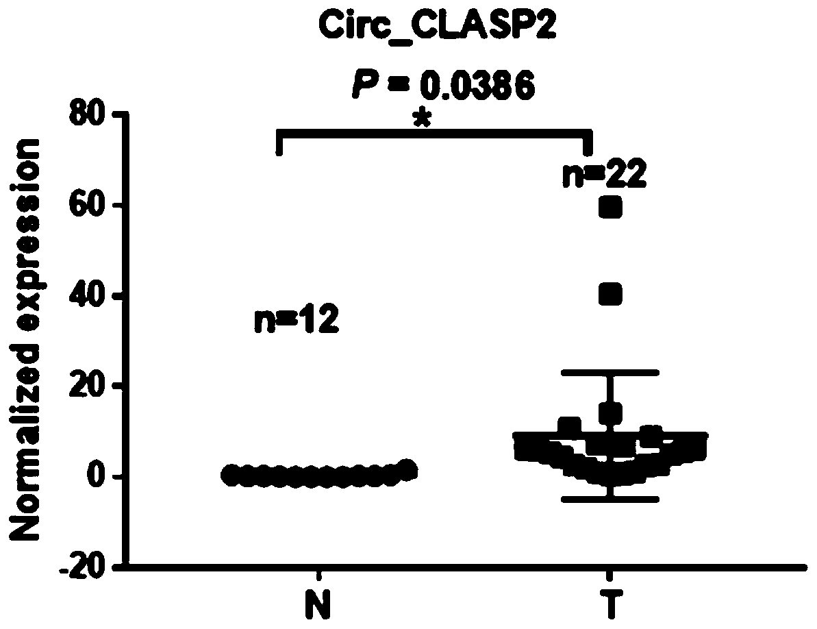 Application and preparation of reagents inhibiting circ_clasp2 in the preparation of nasopharyngeal carcinoma treatment preparations