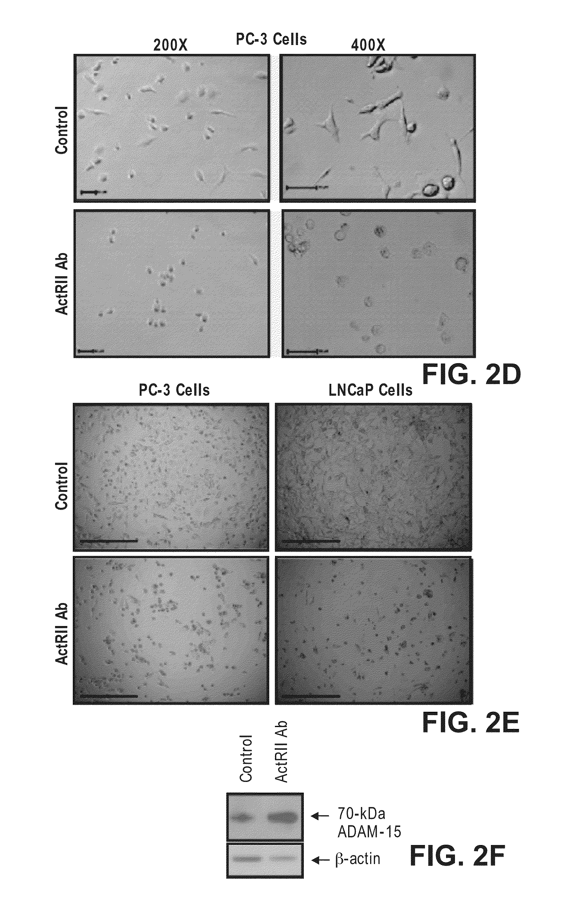 Method for Identifying Agents that Inhibit Cell Migration, Promote Cell Adhesion and Prevent Metastasis