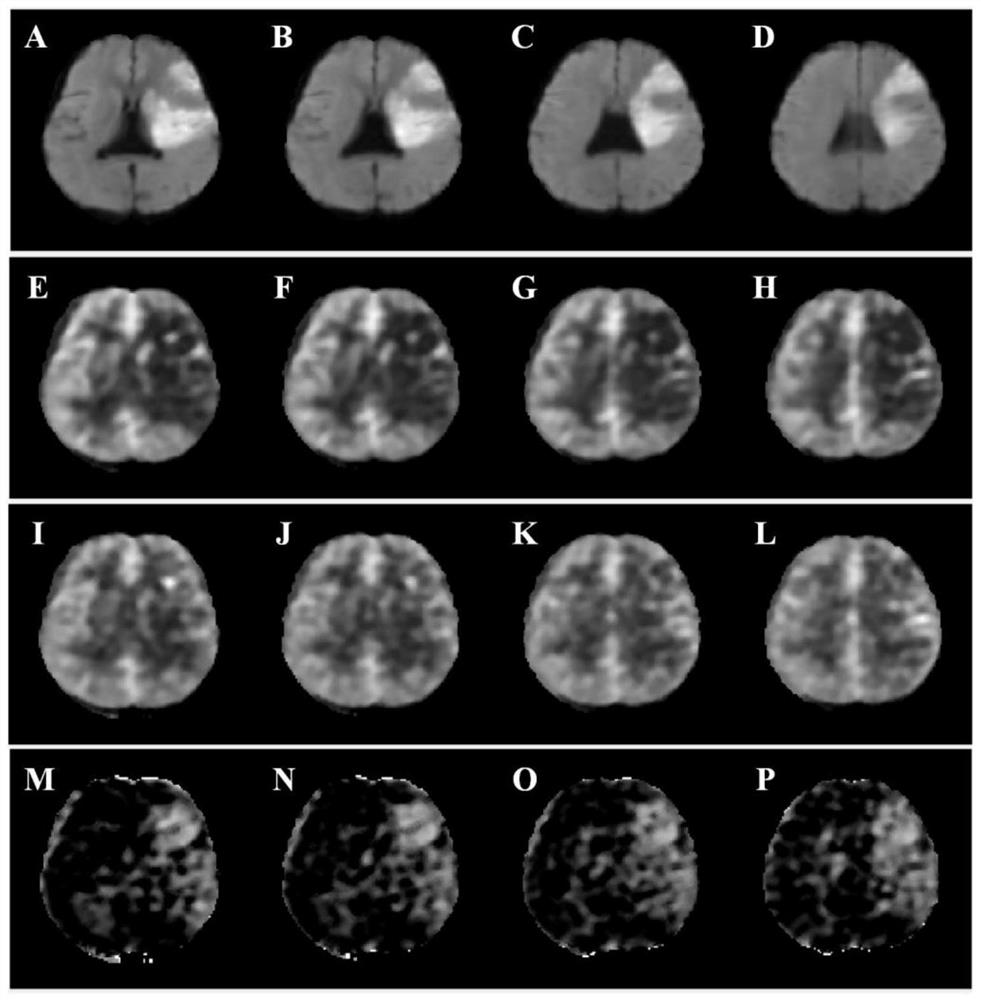 A device for assessing collateral vessel and tissue function based on cerebral blood flow