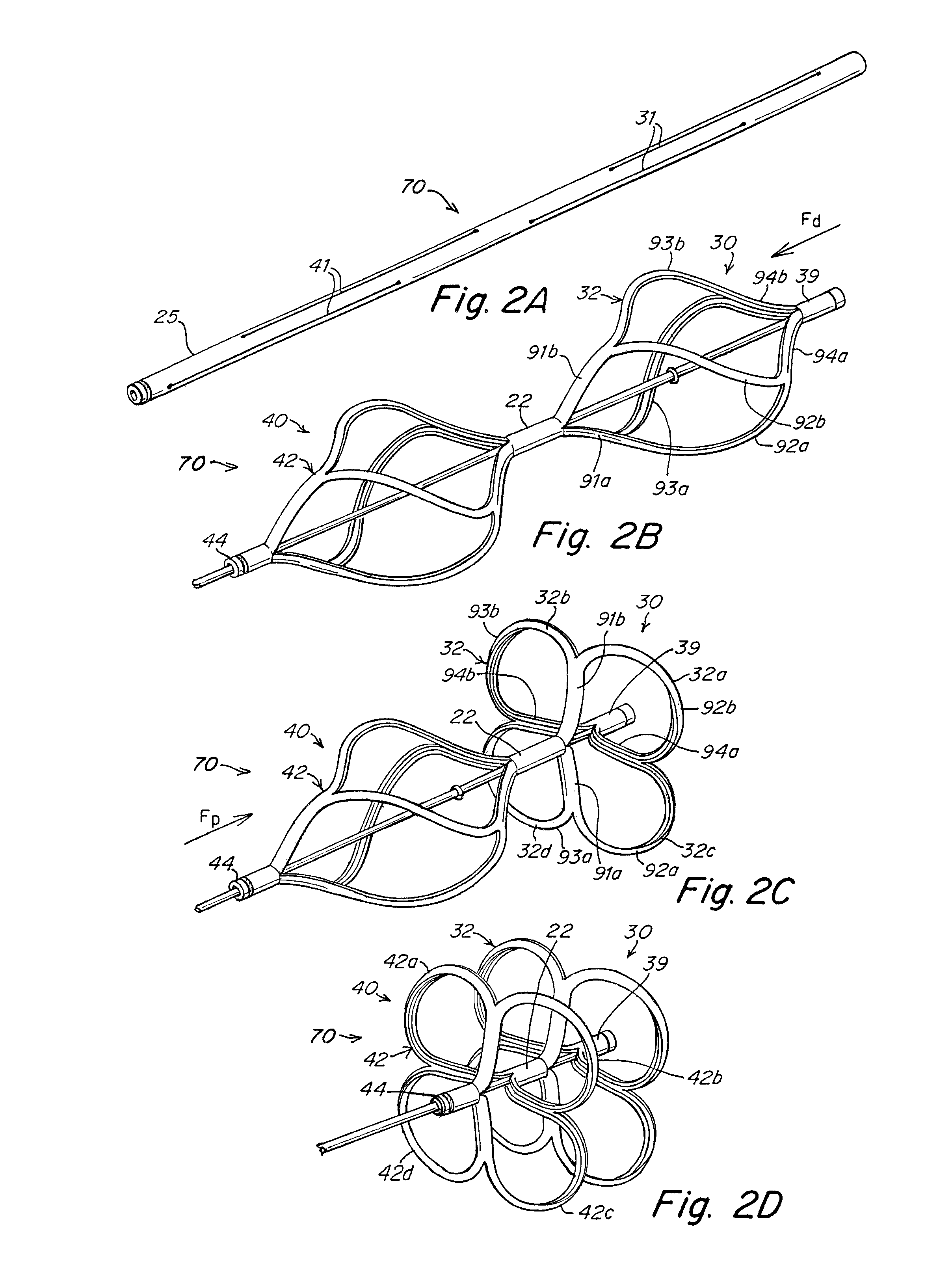 Implant-catheter attachment mechanism using snare and method of use