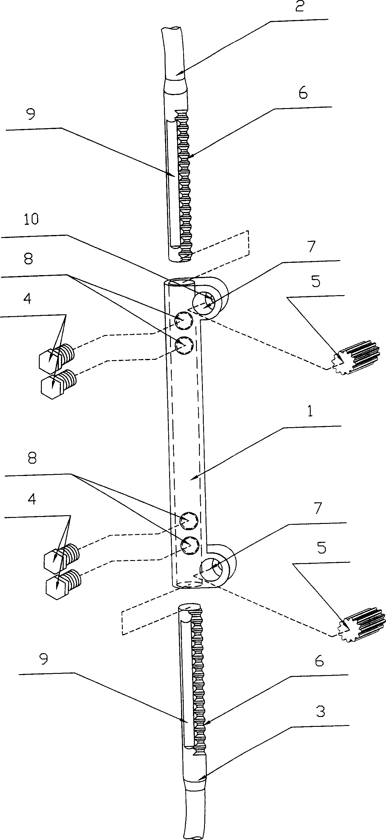 Rachiocampis correction device