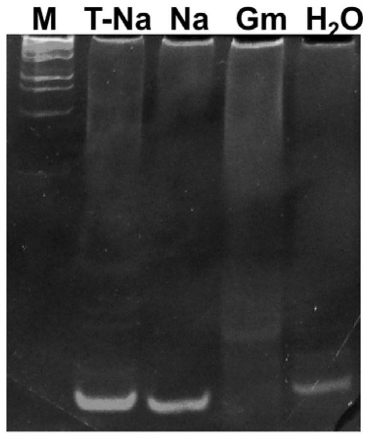 A set of primers for detection of tussah microsporidia and their application