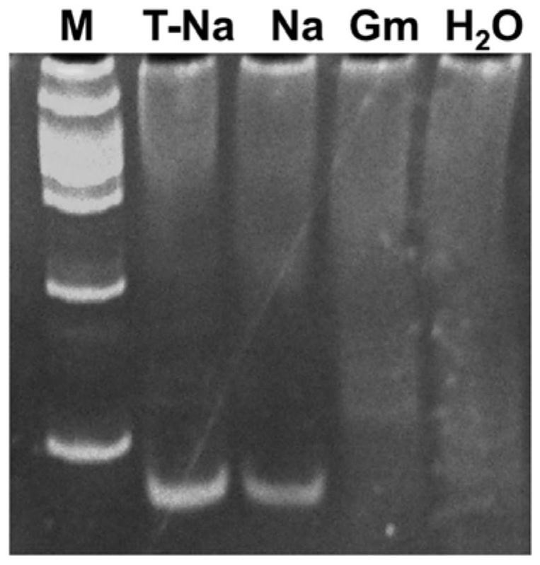 A set of primers for detection of tussah microsporidia and their application
