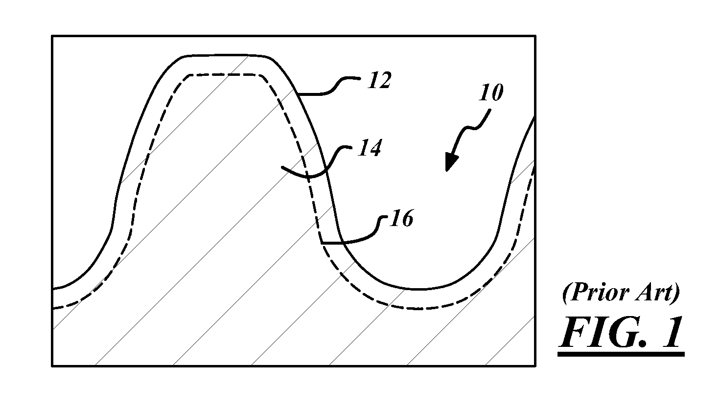 Variable case depth powder metal gear and method thereof
