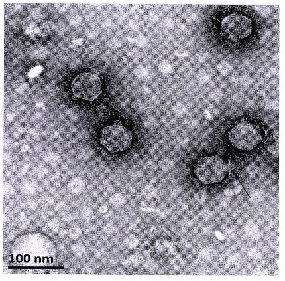 Isolation and Identification of a Novel Enterohaemorrhagic Escherichia coli o157 Phage PE-3 in Sewage Treatment System