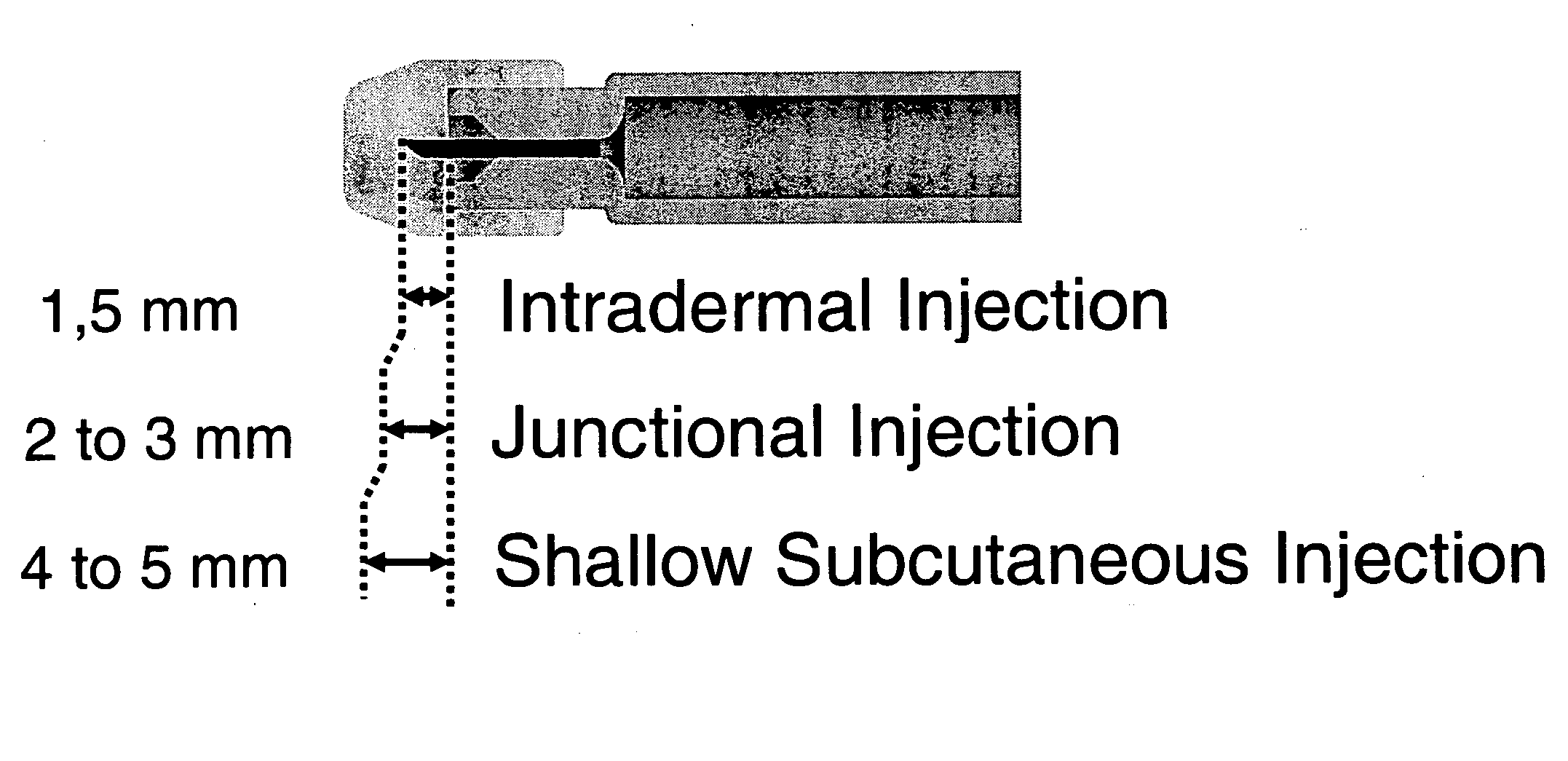 Novel methods for administration of drugs and devices useful thereof
