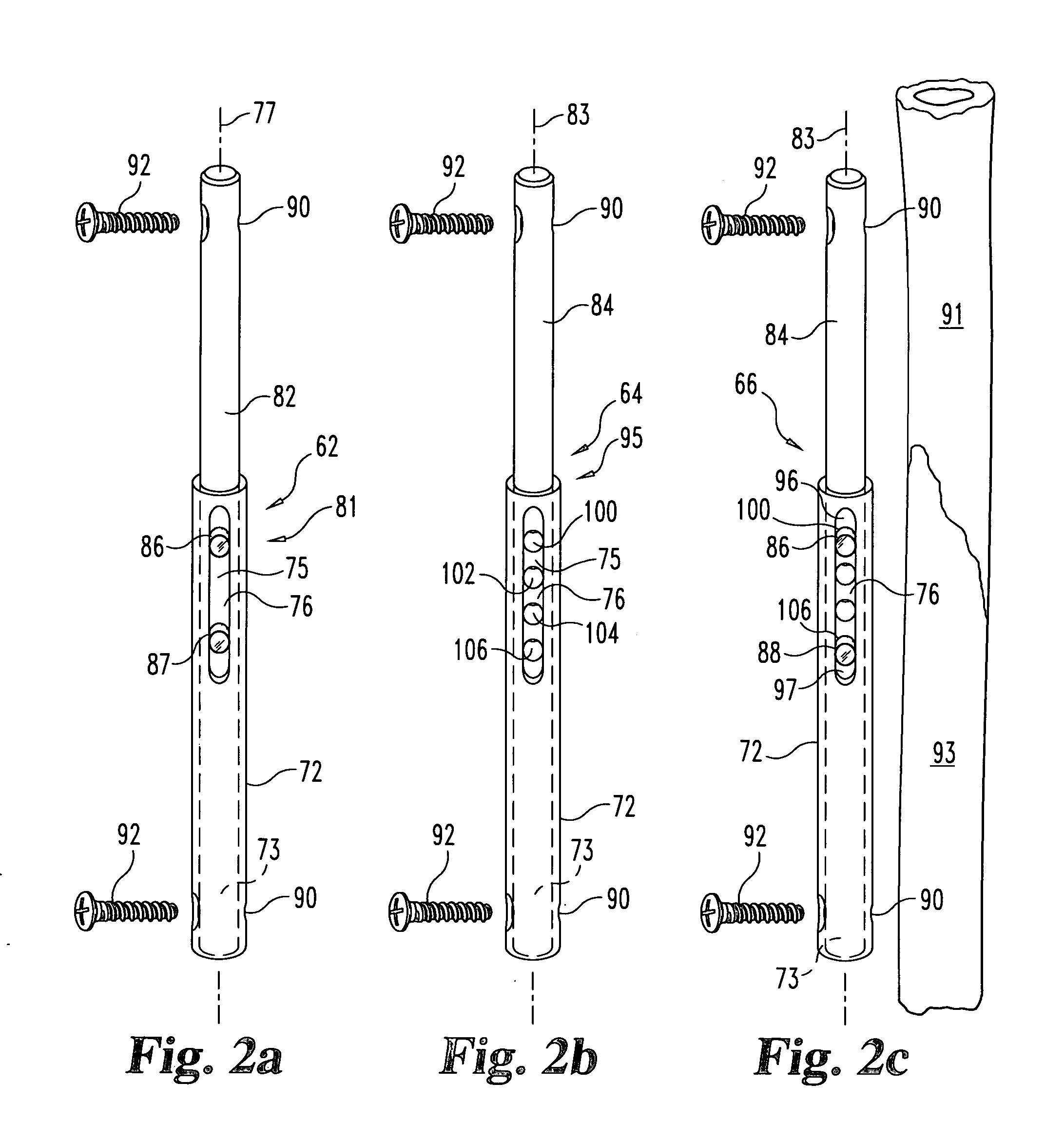Apparatus and method for providing dynamizable translations to orthopedic implants