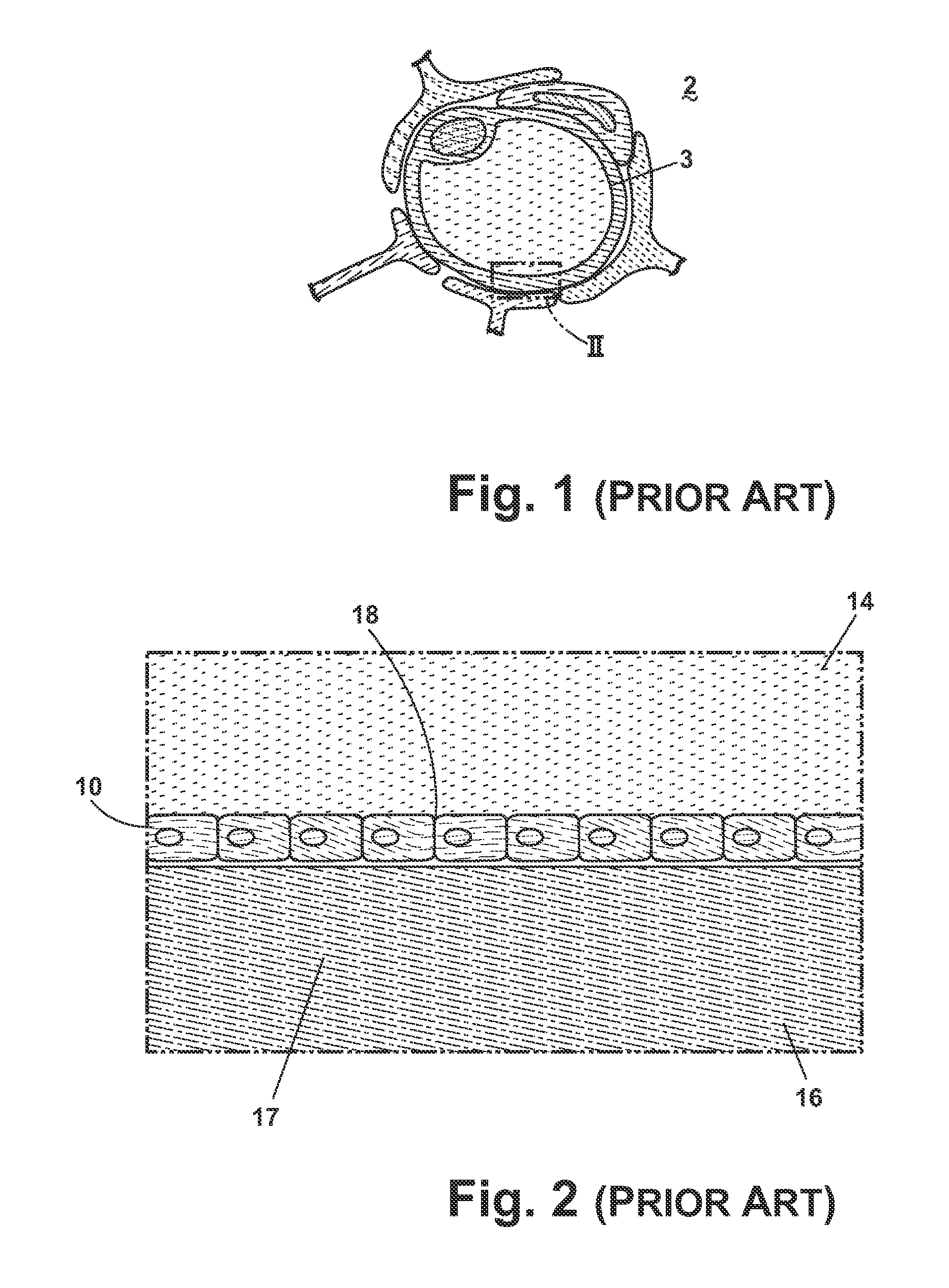 Composition and methods of treatment of bacterial meningitis