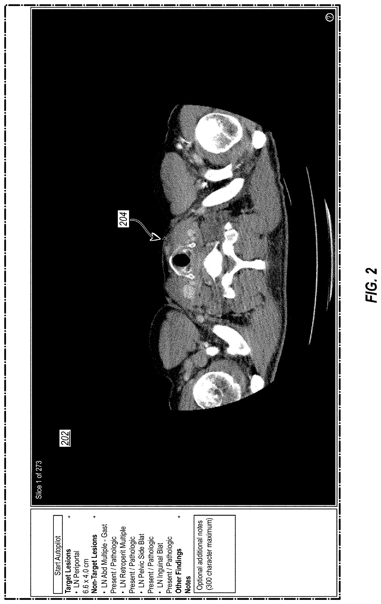 Systems and methods for lesion analysis