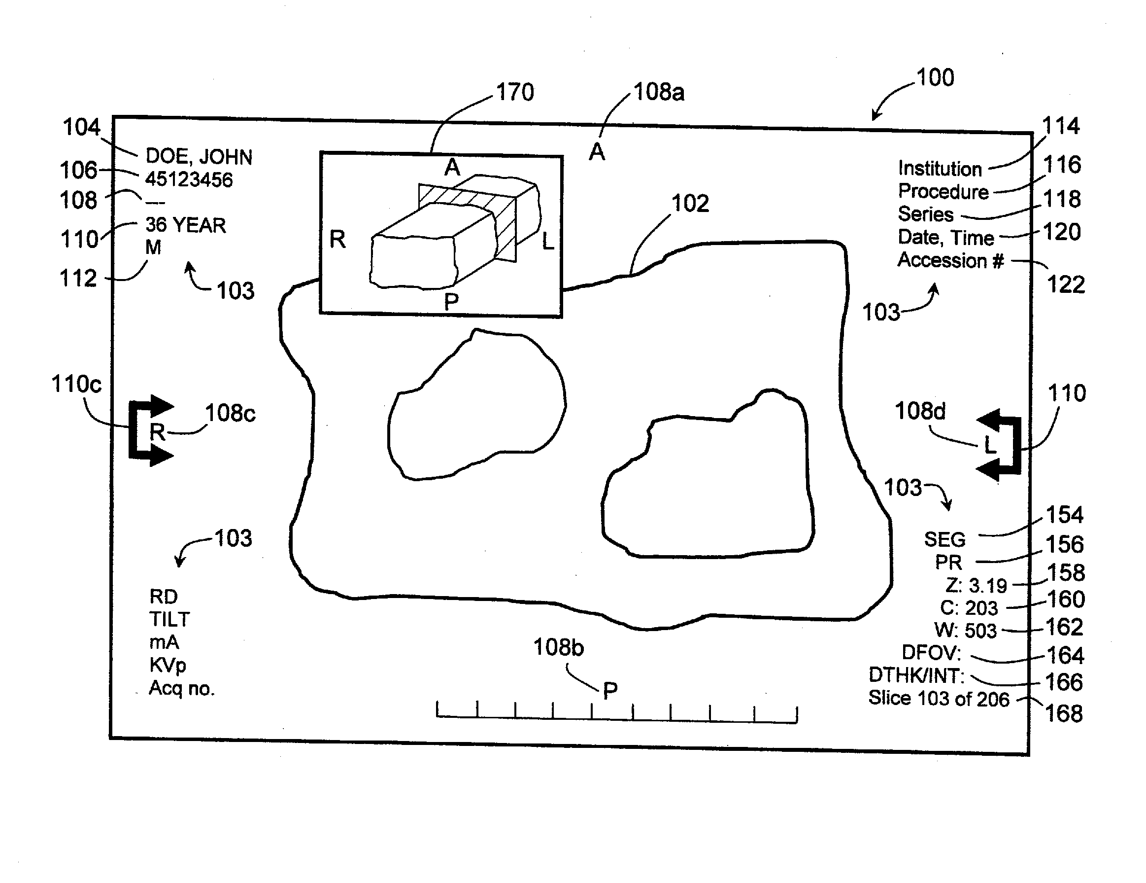 Active Overlay System and Method for Accessing and Manipulating Imaging Displays