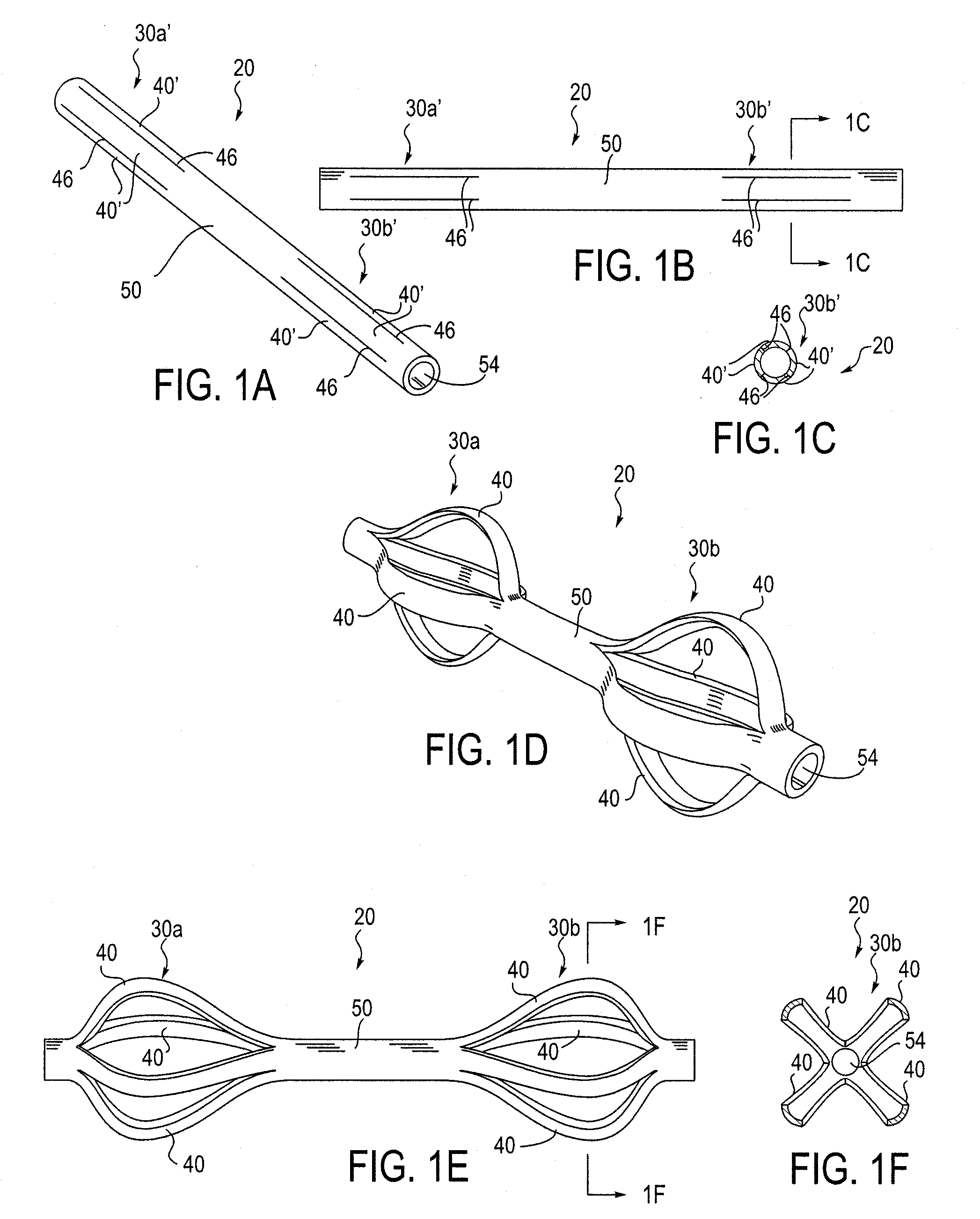 Fracture Fixation System and Method