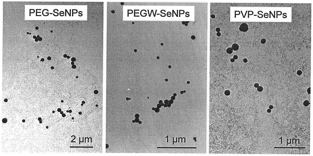 Application of nano selenium as X-ray radiation therapy sensitizer