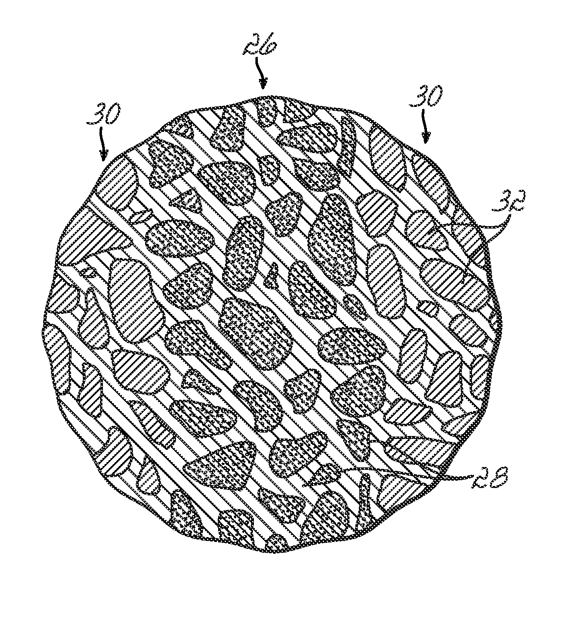 Medical implant formed from porous metal and method