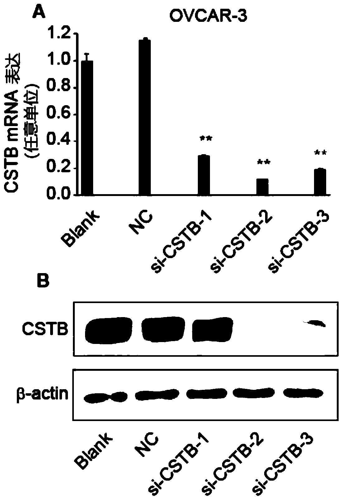 SiRNA molecule against human cysteine proteinase inhibitor B (CSTB) and application thereof