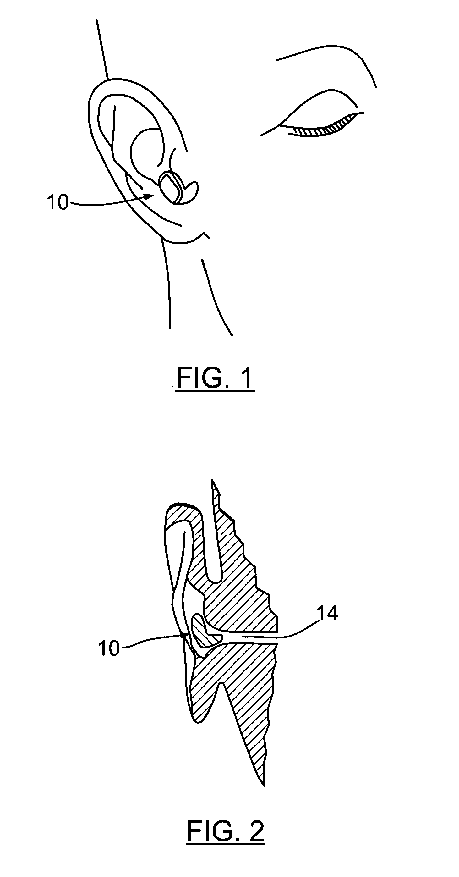 Training device and method to suppress sounds caused by sleep and breathing disorders