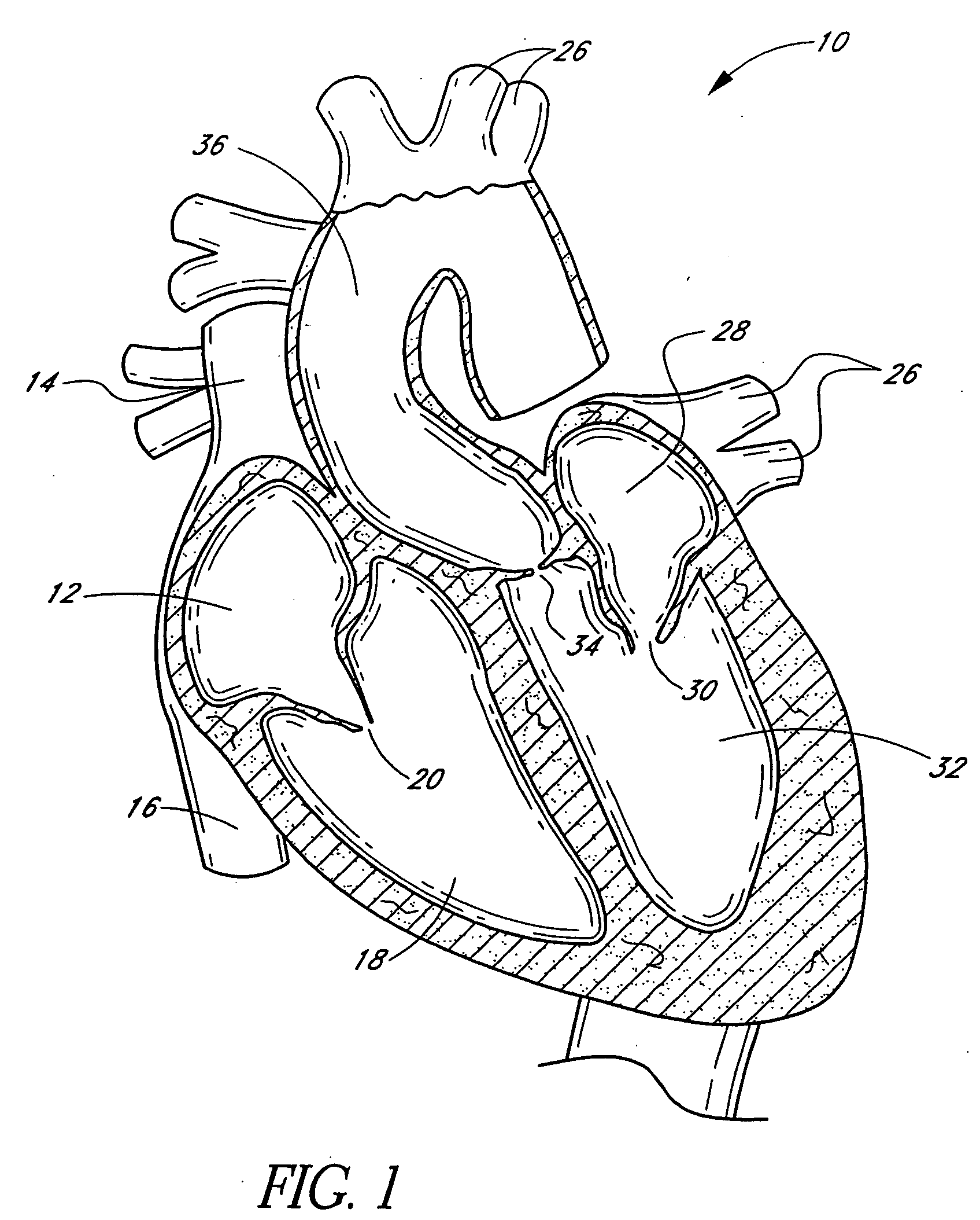 Nonstented heart valves with formed in situ support