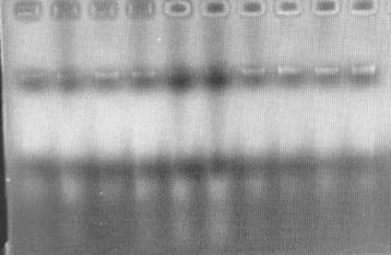 Method and kit for rapidly extracting DNA of soil