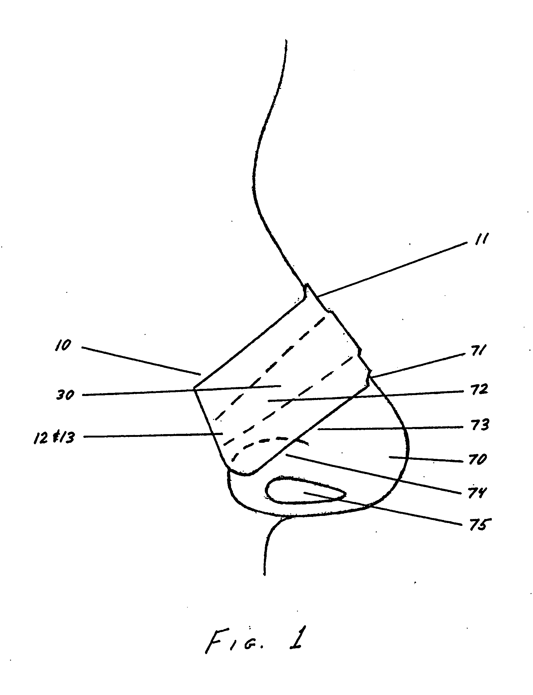 Nasal strip with variable spring rate
