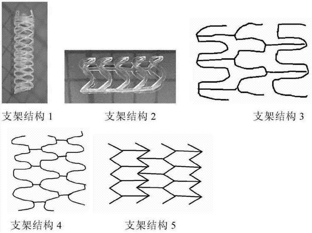 Modified polylactic acid degradable stent and preparation method thereof