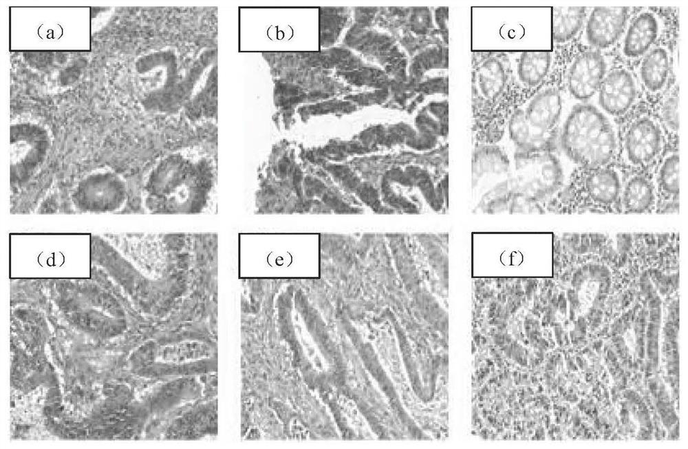 Gland cell image segmentation method and system based on improved U-Net network