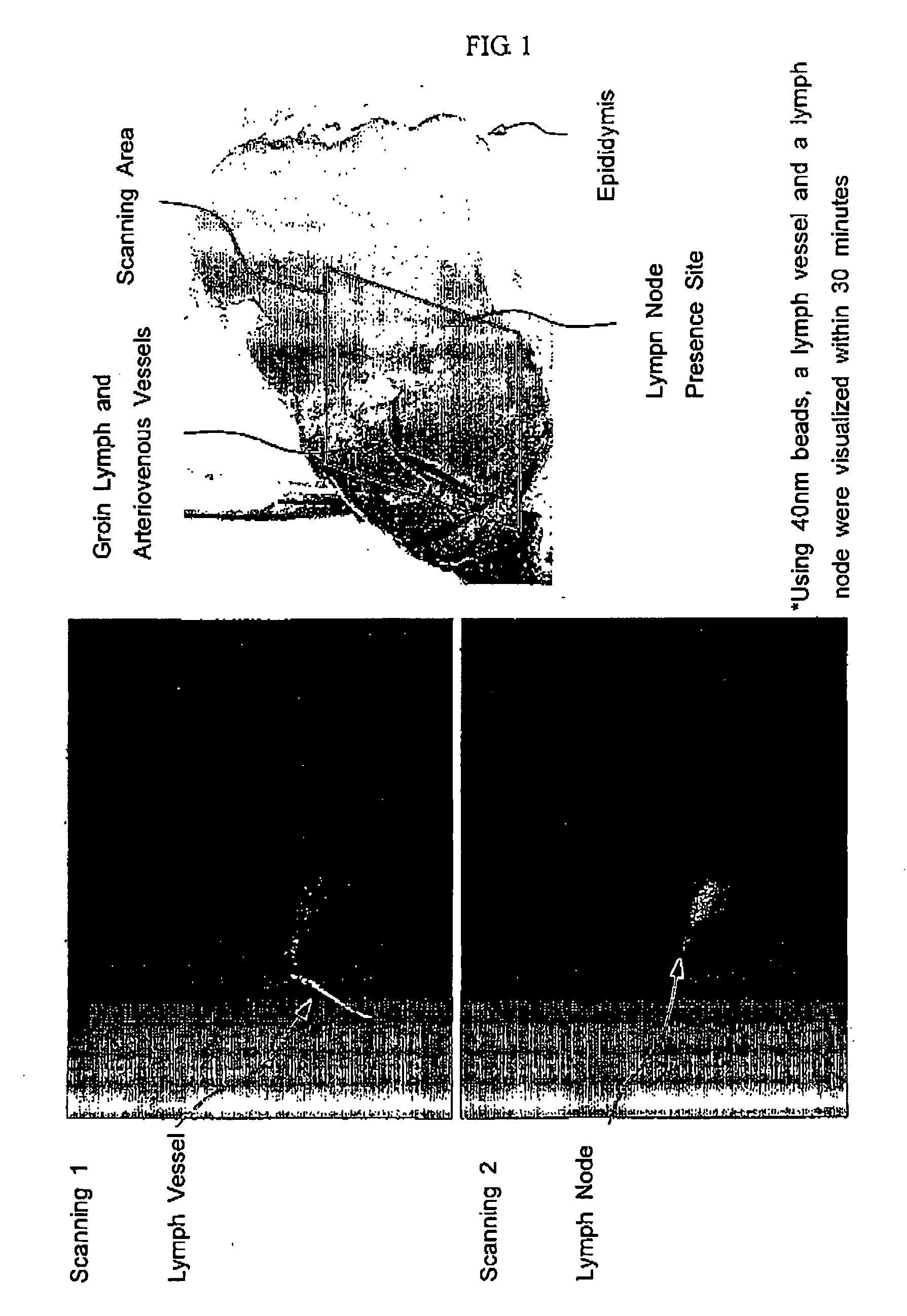 Agent for detecting sentinel lymph node and detection method