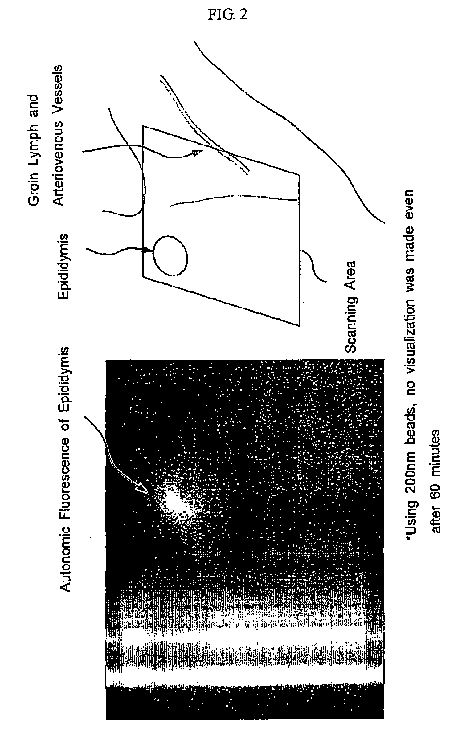 Agent for detecting sentinel lymph node and detection method