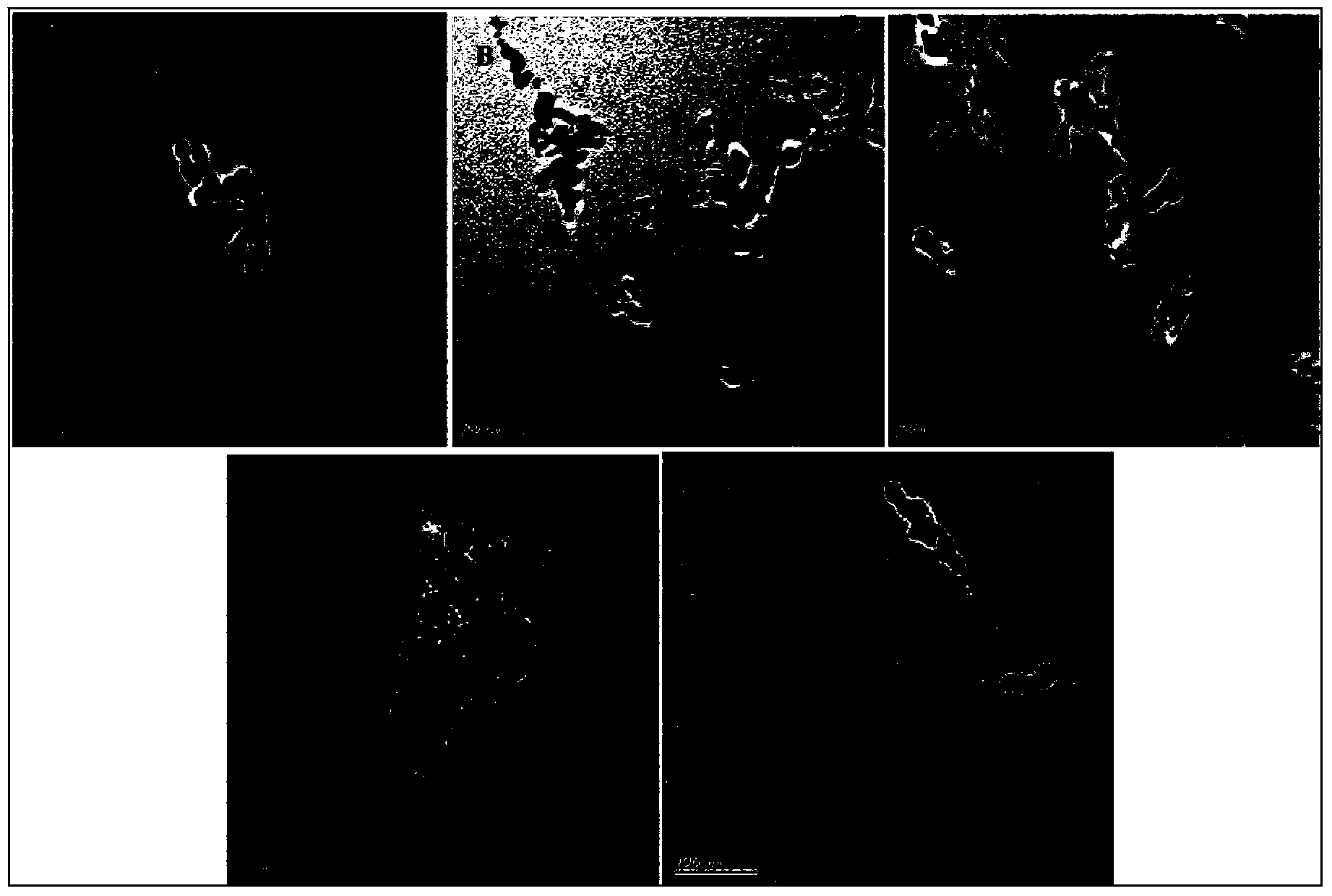 Preparation method of europium-doped hydroxyapatite (HAP) fluorescent nanoparticles