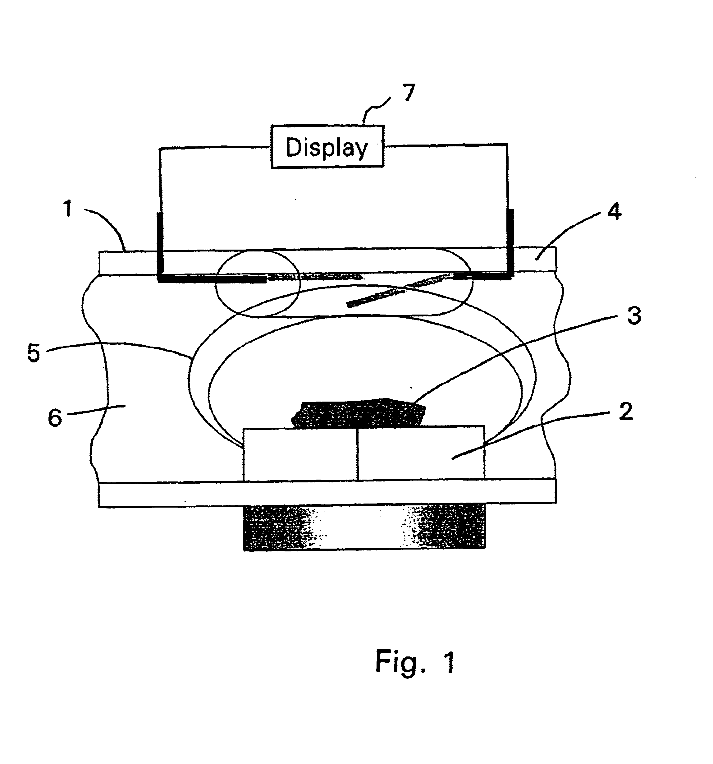 Method and device for machine diagnosis, especially for transmission diagnosis