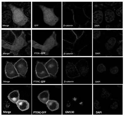 N-terminal extension type PTEN subtype PTEN zeta protein as well as coding gene and application thereof