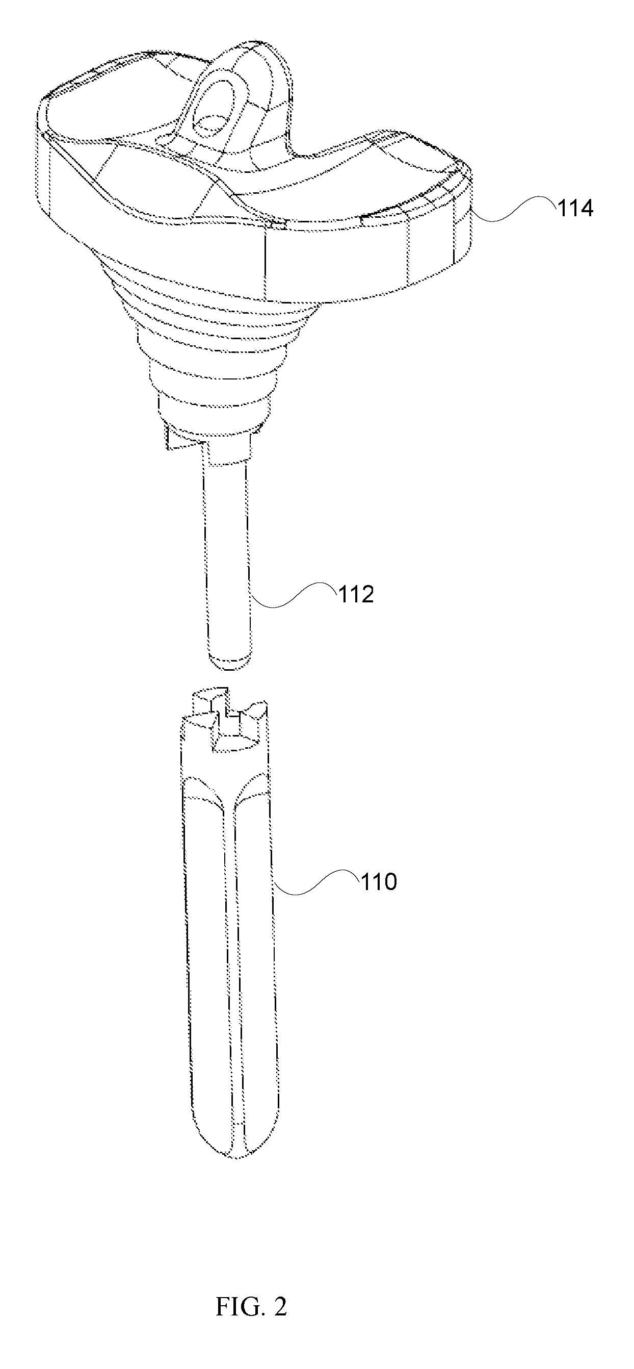Implant system for knee prosthesis