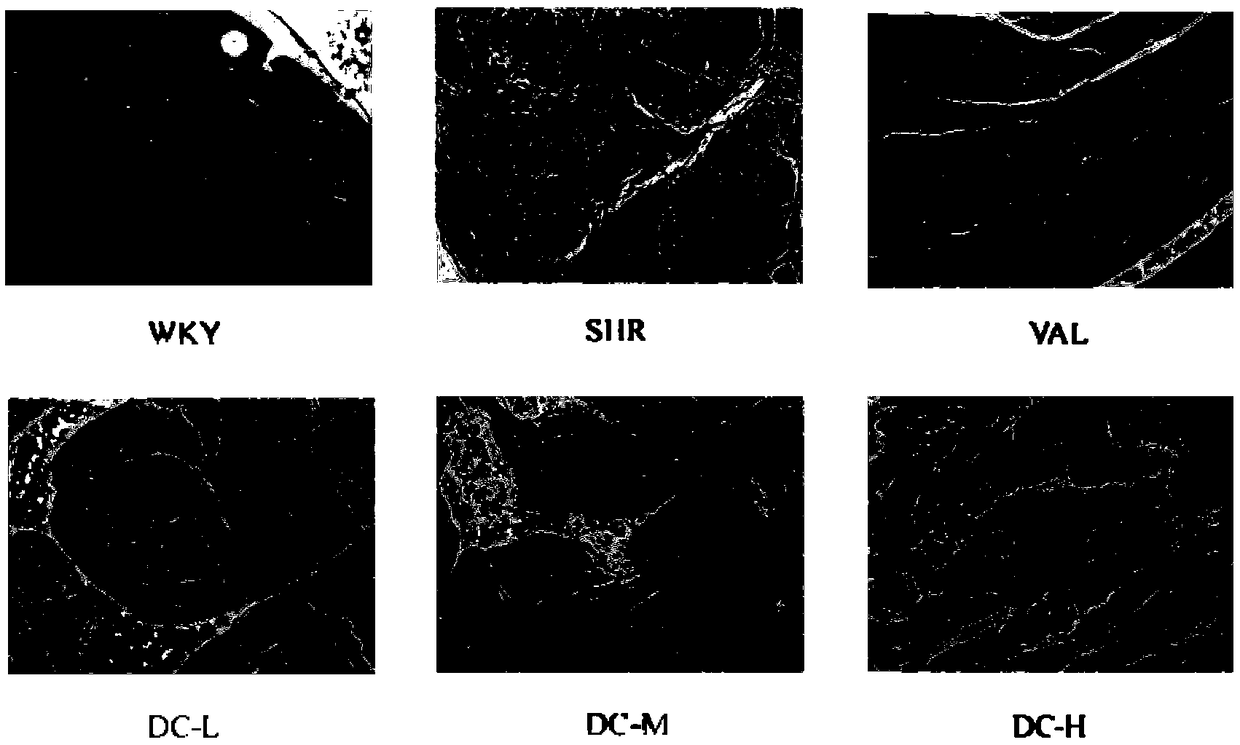 Application of Danshexinkun C in preparation of medicines treating hypertensive heart muscle fibrosis