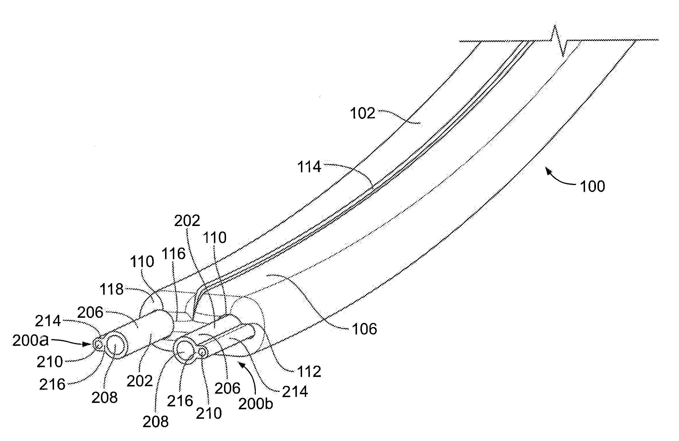 Catheter Systems and Methods of Use