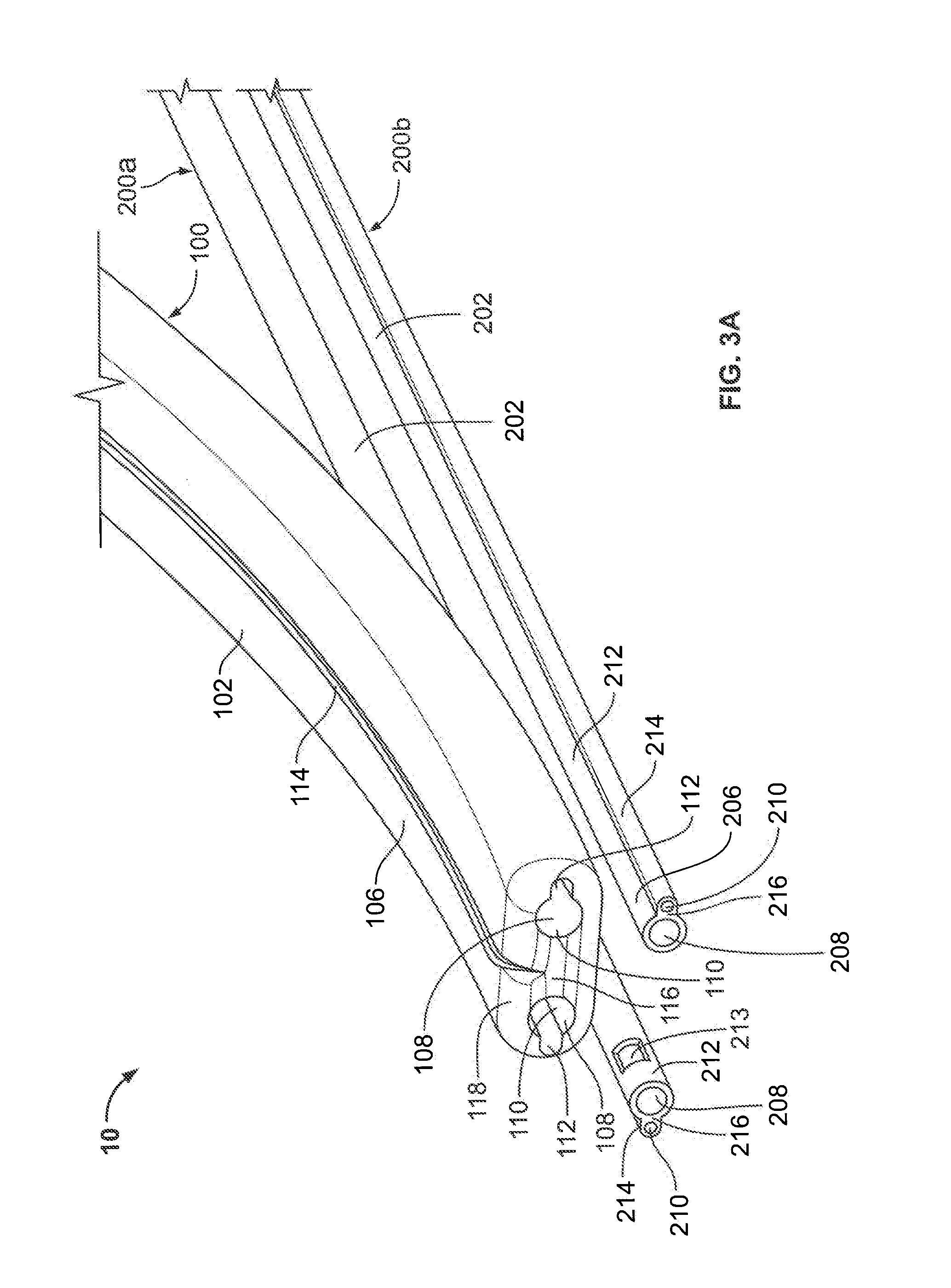 Catheter Systems and Methods of Use