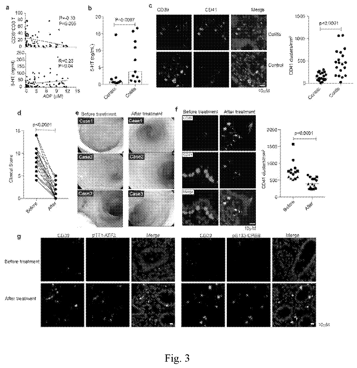 Immunity mechanism and therapeutic drug for gastrointestinal diseases