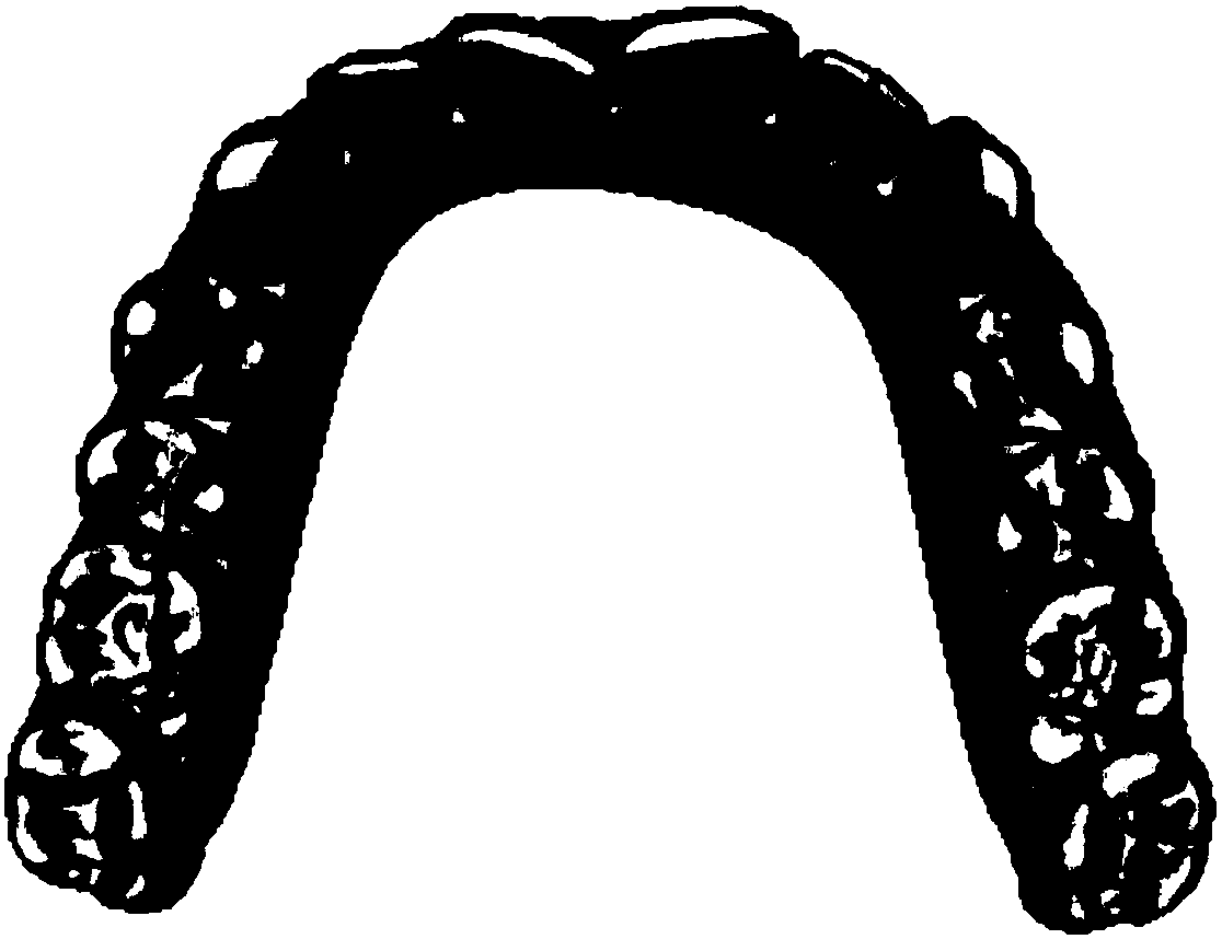 A Collision Detection Method for the Calculation of Upper and Lower Jaw Occlusal Areas