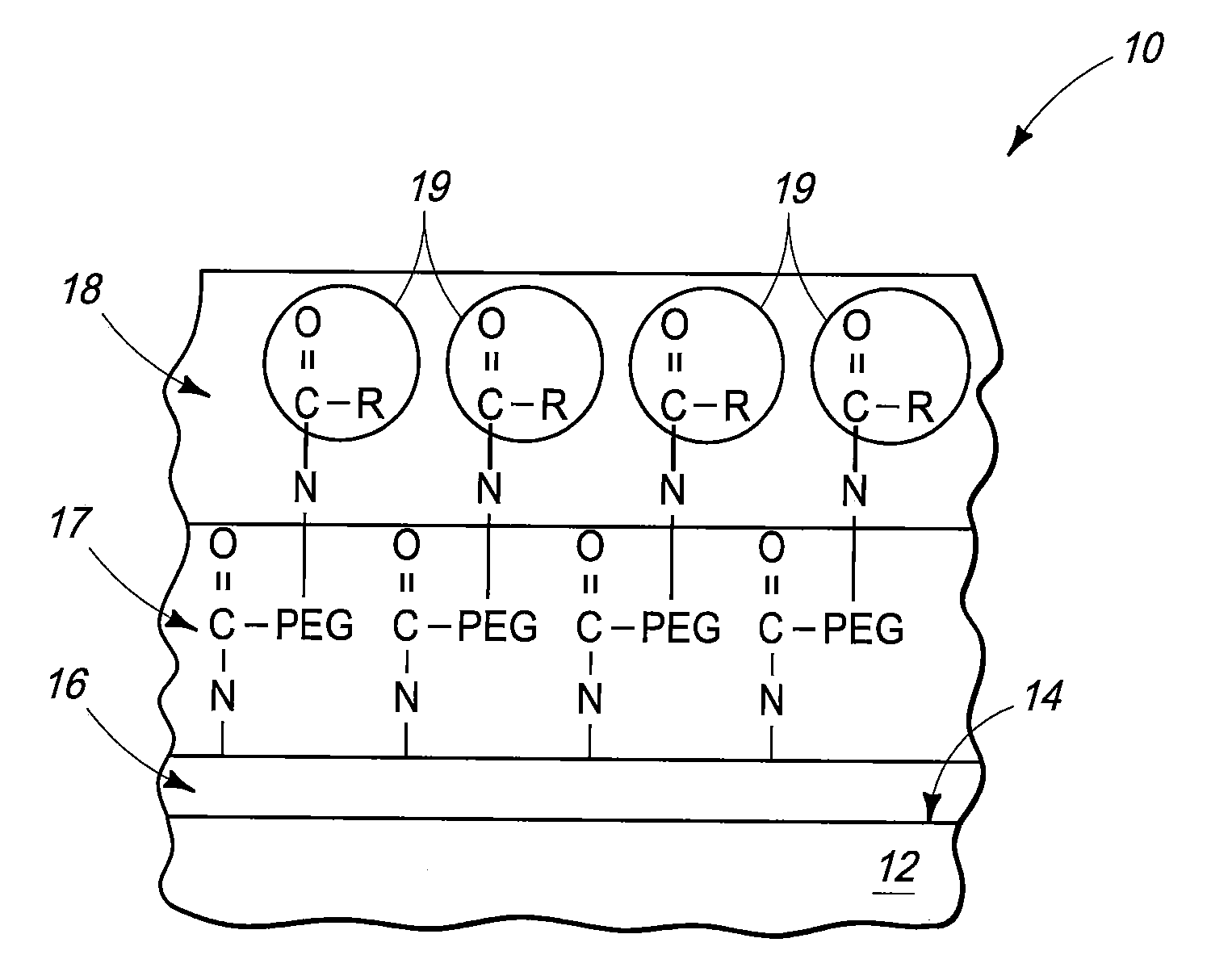 Medical Implants and Methods of Making Medical Implants