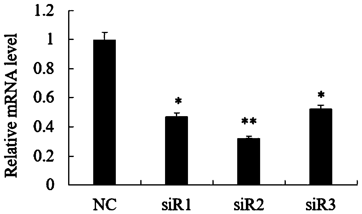 siRNA interfering Mroh7 gene expression and application, interfering method and drug thereof