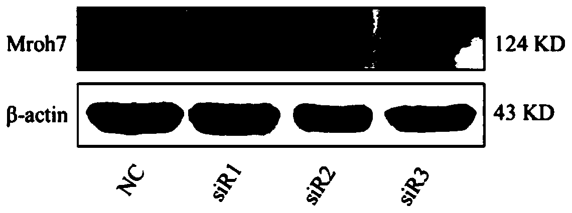 siRNA interfering Mroh7 gene expression and application, interfering method and drug thereof