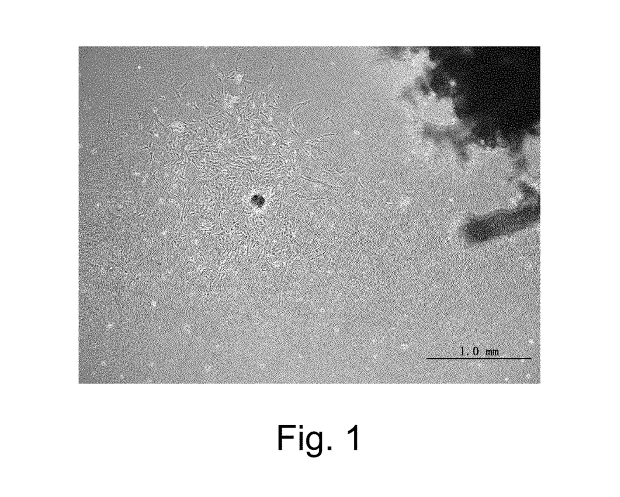 Placenta-derived potential cells and preparing method thereof