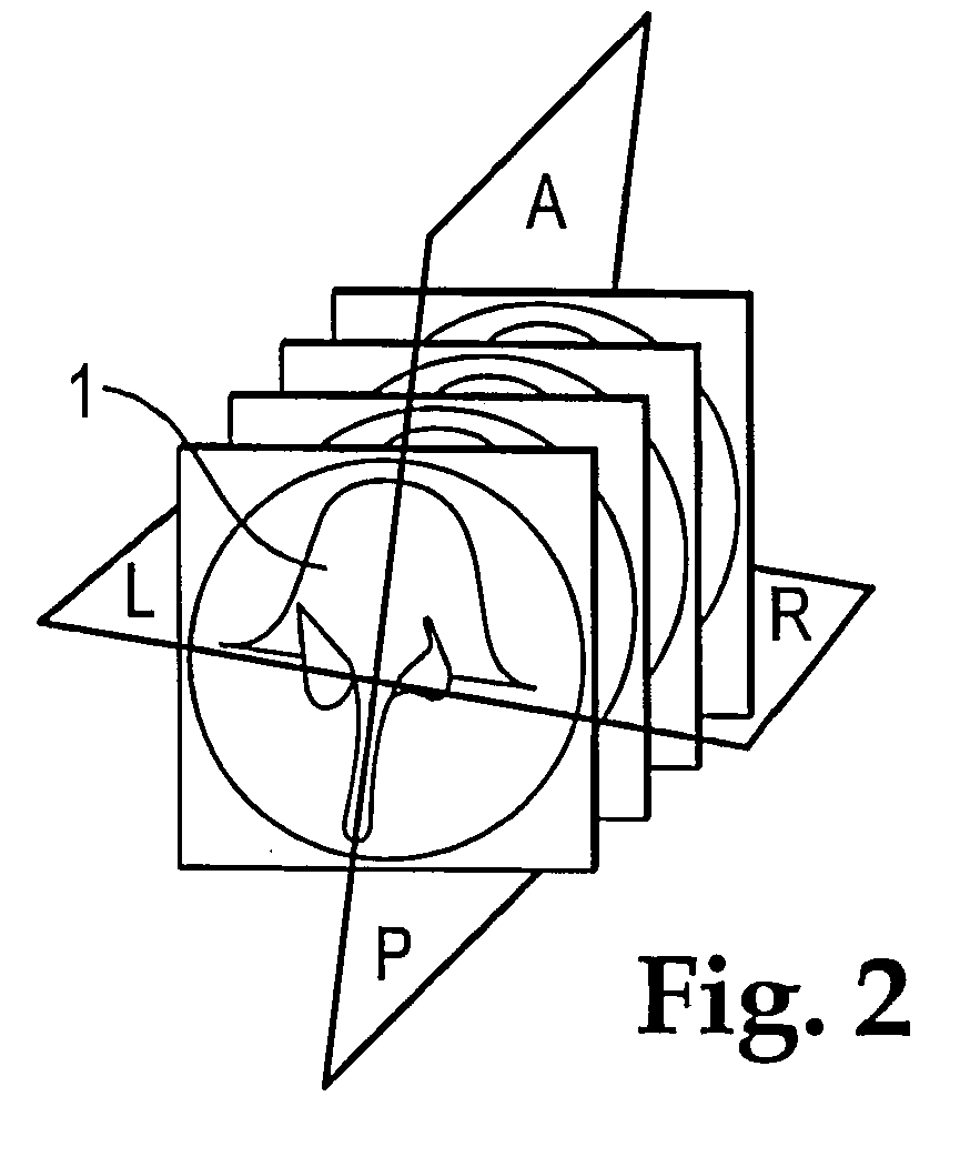 Method for verifying the relative position of bone structures