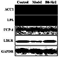 Bacillus licheniformis (BL)3 Silence information regulator (Sir)2-like protein capable of relieving nonalcoholic fatty liver disease (NAFLD) tissue lesions and application of BL3 Sir2 protein