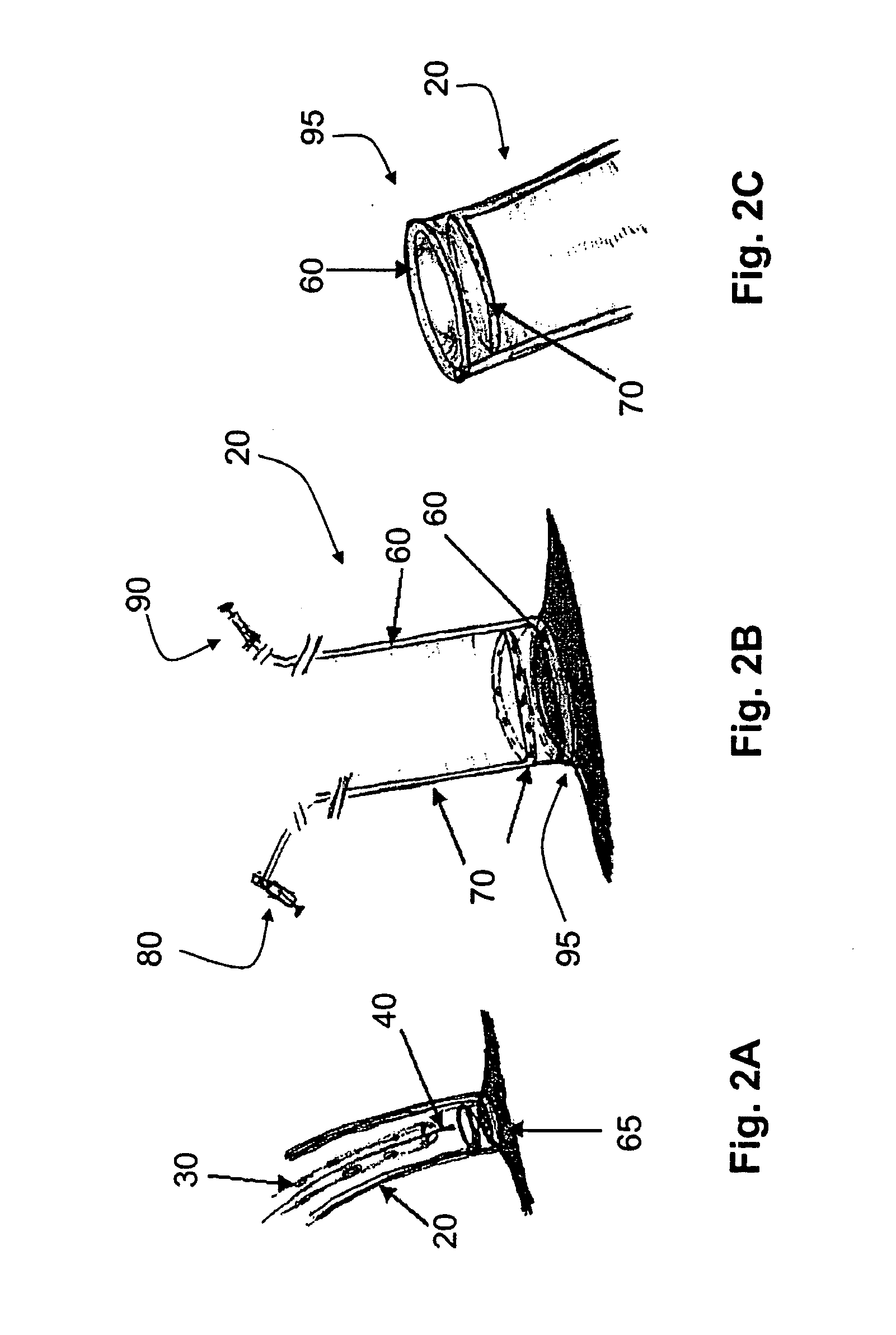 Devices, systems, and methods for pericardial access